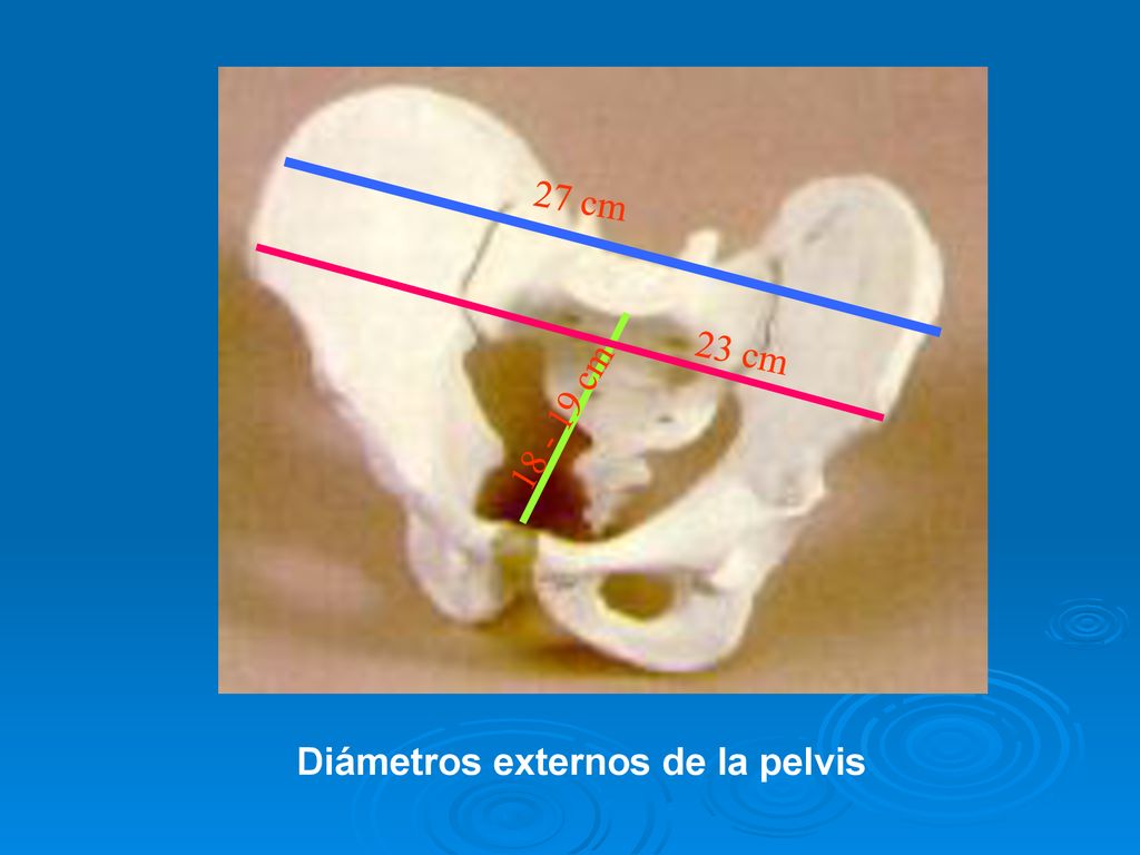 27 cm 23 cm cm Diámetros externos de la pelvis