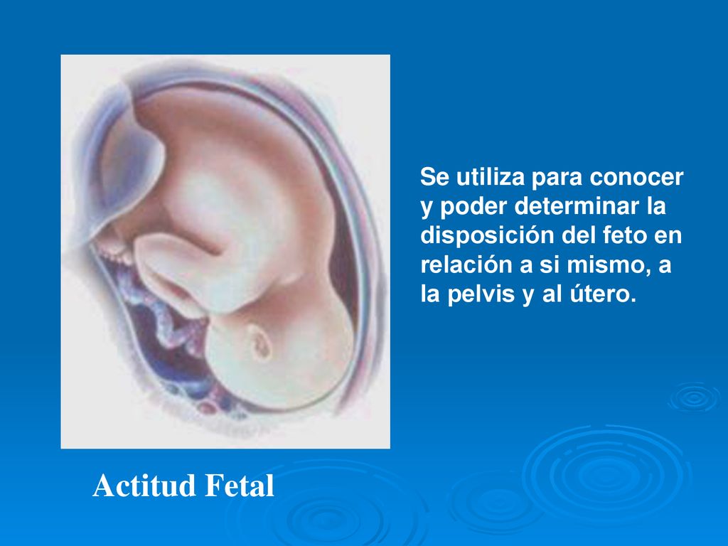 Se utiliza para conocer y poder determinar la disposición del feto en relación a si mismo, a la pelvis y al útero.