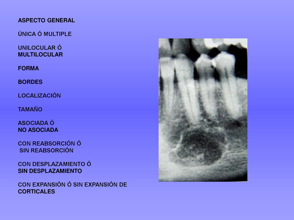 ASPECTO GENERAL ÚNICA Ó MULTIPLE. UNILOCULAR Ó MULTILOCULAR. FORMA. BORDES.