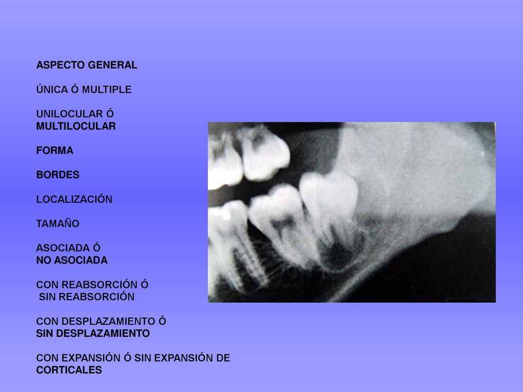 ASPECTO GENERAL ÚNICA Ó MULTIPLE. UNILOCULAR Ó. MULTILOCULAR. FORMA. BORDES. LOCALIZACIÓN. TAMAÑO.