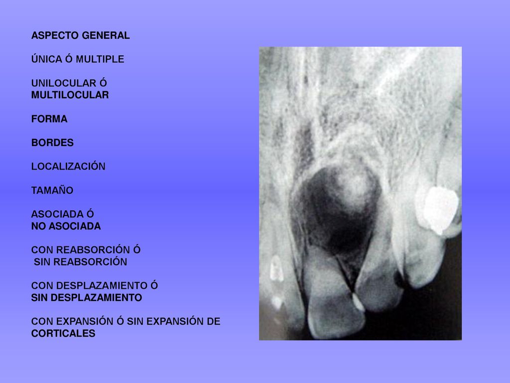 ASPECTO GENERAL ÚNICA Ó MULTIPLE. UNILOCULAR Ó. MULTILOCULAR. FORMA. BORDES. LOCALIZACIÓN. TAMAÑO.
