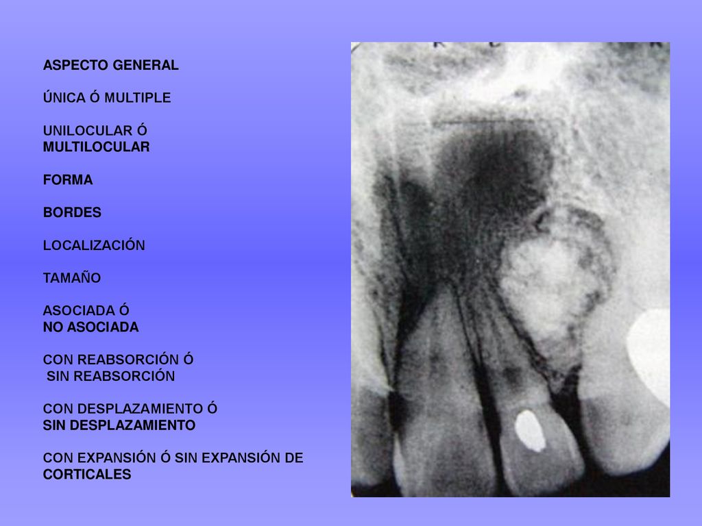 ASPECTO GENERAL ÚNICA Ó MULTIPLE. UNILOCULAR Ó. MULTILOCULAR. FORMA. BORDES. LOCALIZACIÓN. TAMAÑO.