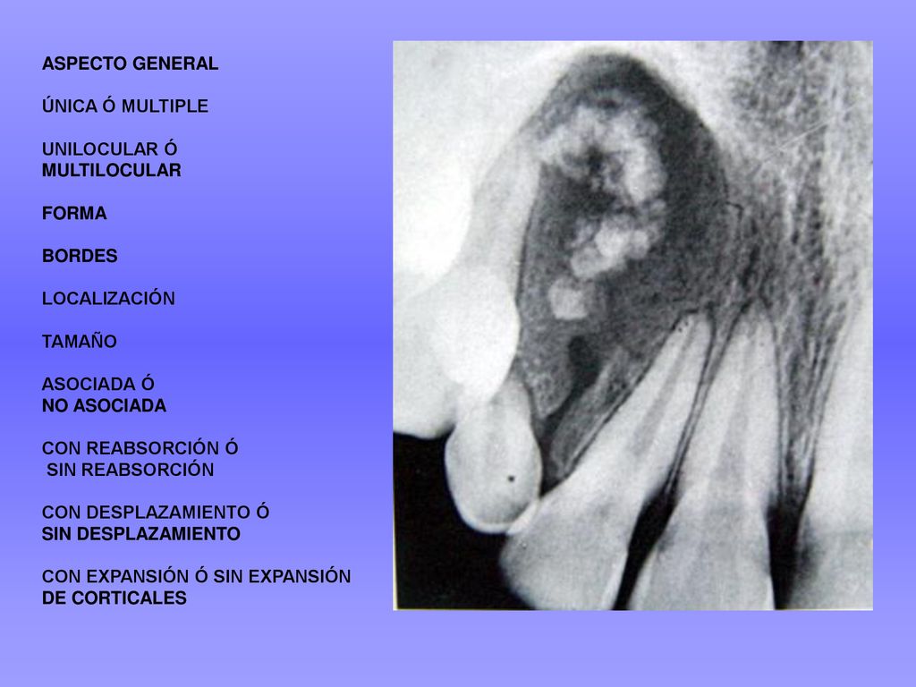 ASPECTO GENERAL ÚNICA Ó MULTIPLE. UNILOCULAR Ó. MULTILOCULAR. FORMA. BORDES. LOCALIZACIÓN. TAMAÑO.