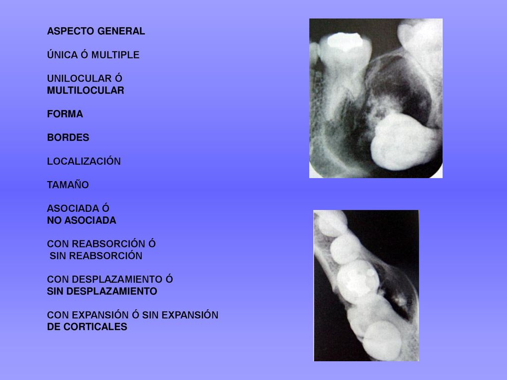 ASPECTO GENERAL ÚNICA Ó MULTIPLE. UNILOCULAR Ó. MULTILOCULAR. FORMA. BORDES. LOCALIZACIÓN. TAMAÑO.