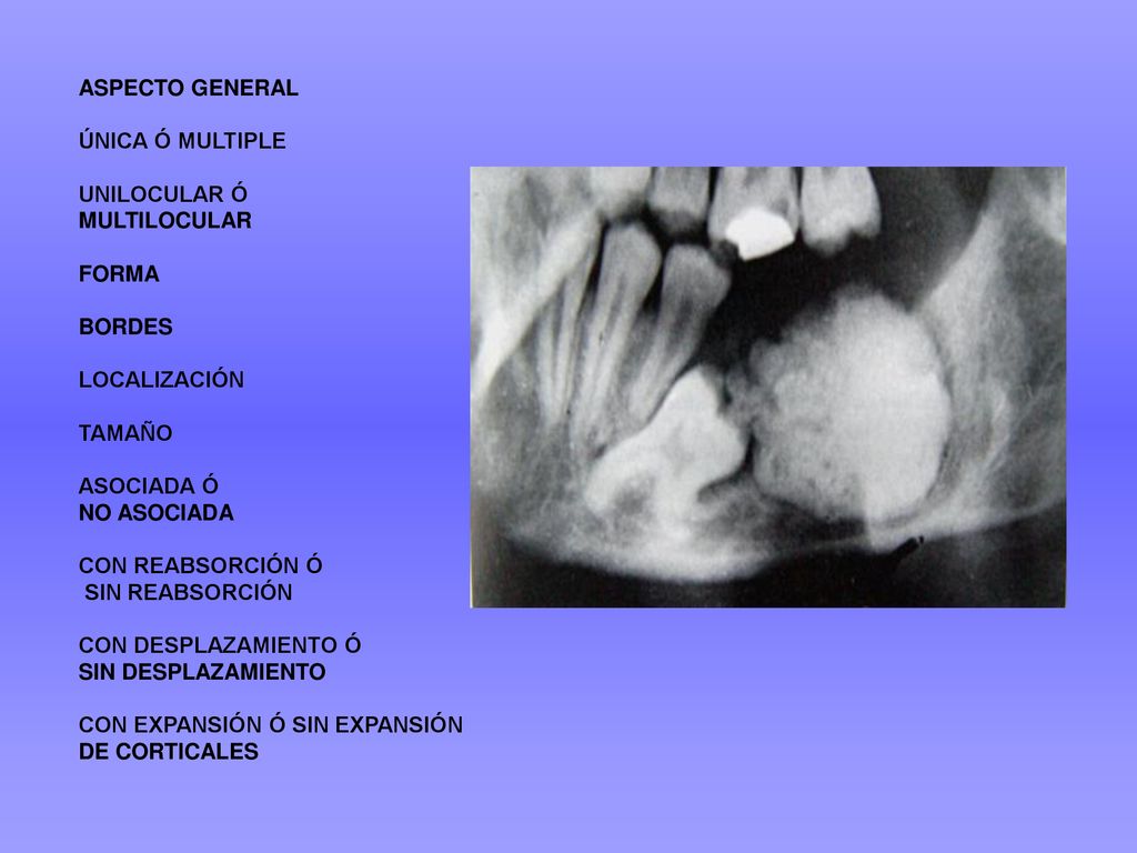ASPECTO GENERAL ÚNICA Ó MULTIPLE. UNILOCULAR Ó. MULTILOCULAR. FORMA. BORDES. LOCALIZACIÓN. TAMAÑO.