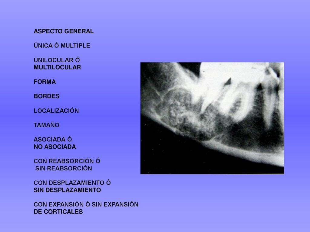 ASPECTO GENERAL ÚNICA Ó MULTIPLE. UNILOCULAR Ó. MULTILOCULAR. FORMA. BORDES. LOCALIZACIÓN. TAMAÑO.