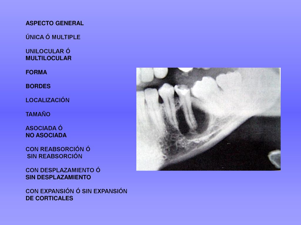 ASPECTO GENERAL ÚNICA Ó MULTIPLE. UNILOCULAR Ó. MULTILOCULAR. FORMA. BORDES. LOCALIZACIÓN. TAMAÑO.