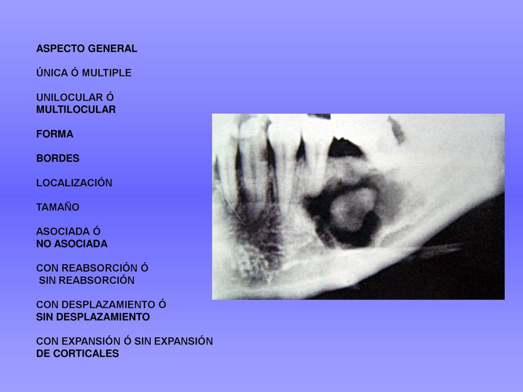 ASPECTO GENERAL ÚNICA Ó MULTIPLE. UNILOCULAR Ó. MULTILOCULAR. FORMA. BORDES. LOCALIZACIÓN. TAMAÑO.