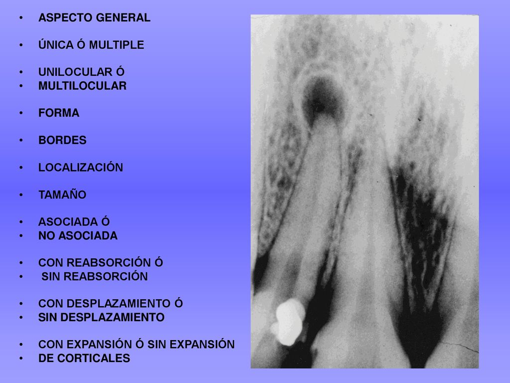 ASPECTO GENERAL ÚNICA Ó MULTIPLE. UNILOCULAR Ó. MULTILOCULAR. FORMA. BORDES. LOCALIZACIÓN. TAMAÑO.