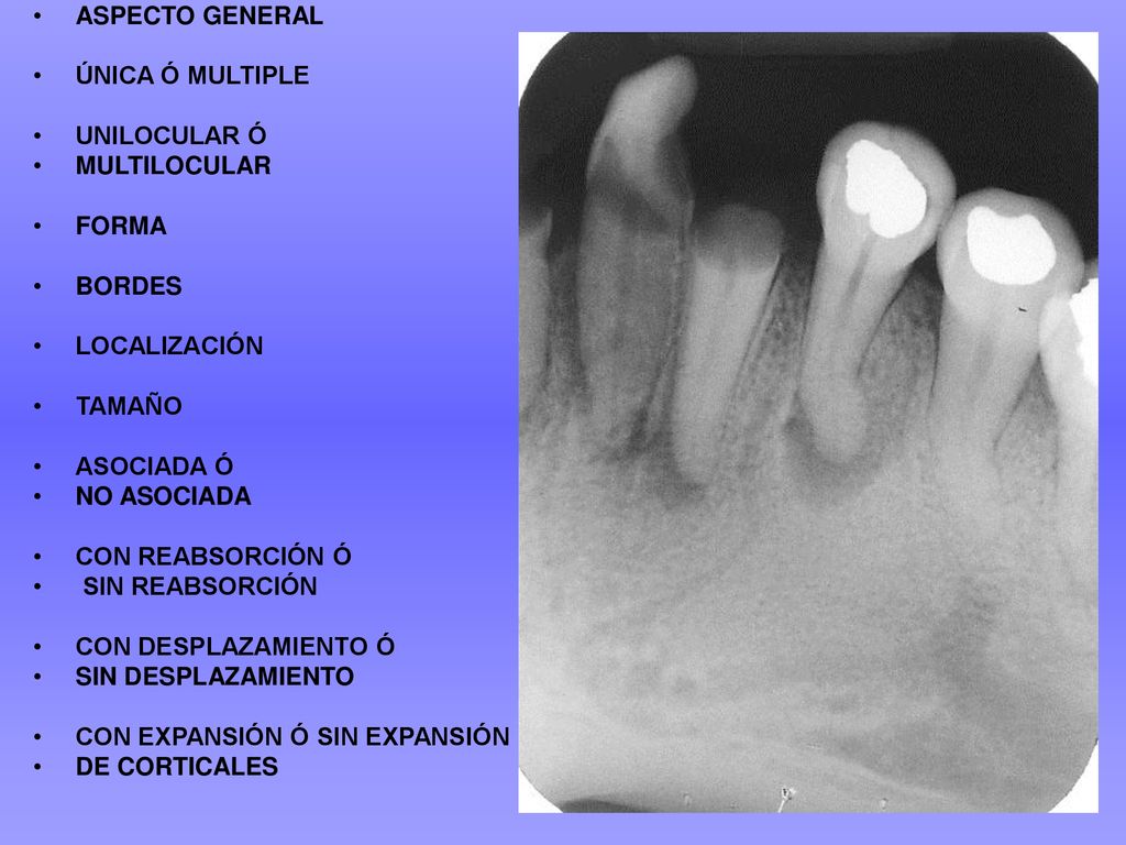 ASPECTO GENERAL ÚNICA Ó MULTIPLE. UNILOCULAR Ó. MULTILOCULAR. FORMA. BORDES. LOCALIZACIÓN. TAMAÑO.