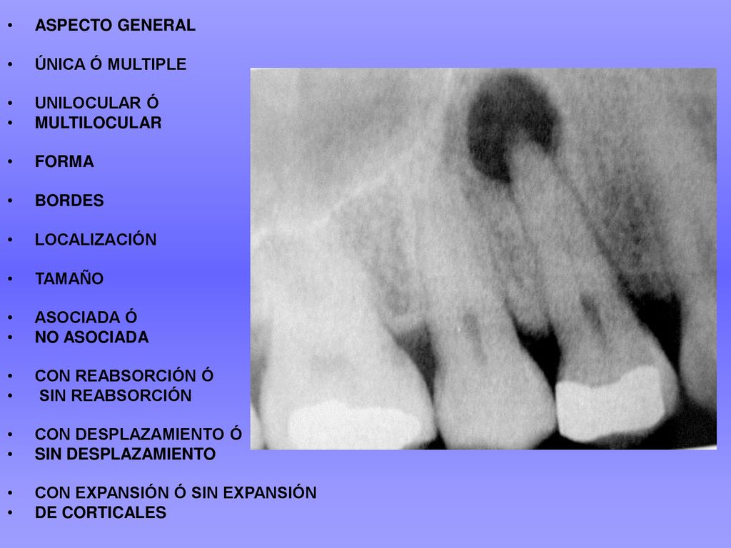 ASPECTO GENERAL ÚNICA Ó MULTIPLE. UNILOCULAR Ó. MULTILOCULAR. FORMA. BORDES. LOCALIZACIÓN. TAMAÑO.