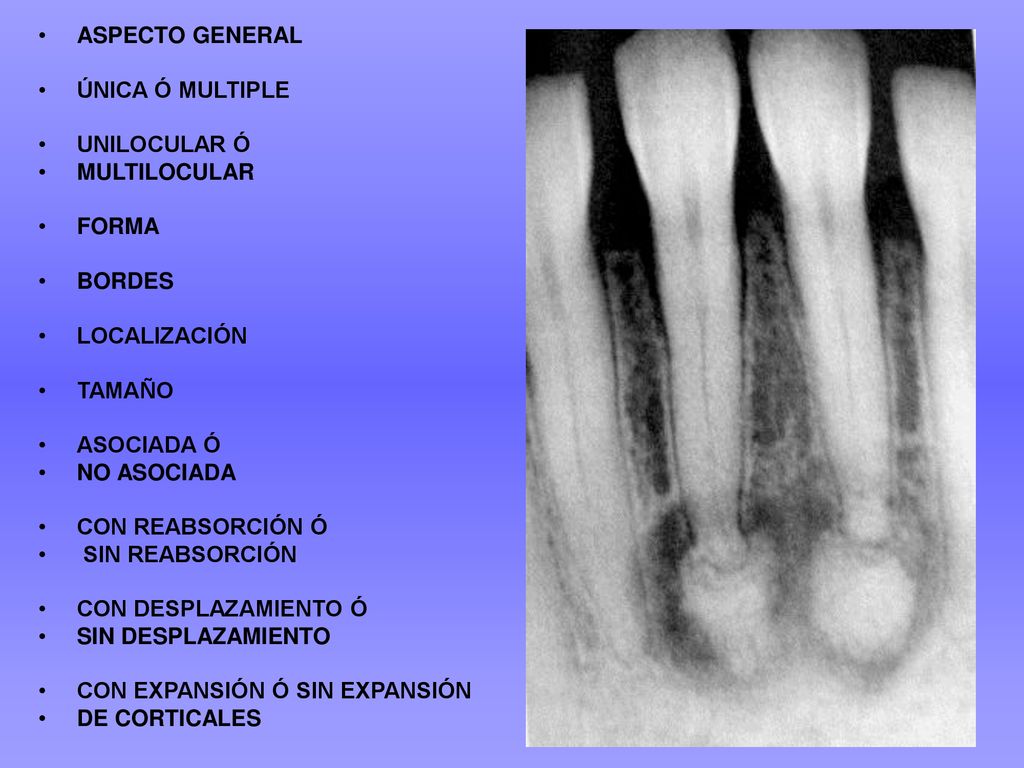 ASPECTO GENERAL ÚNICA Ó MULTIPLE. UNILOCULAR Ó. MULTILOCULAR. FORMA. BORDES. LOCALIZACIÓN. TAMAÑO.