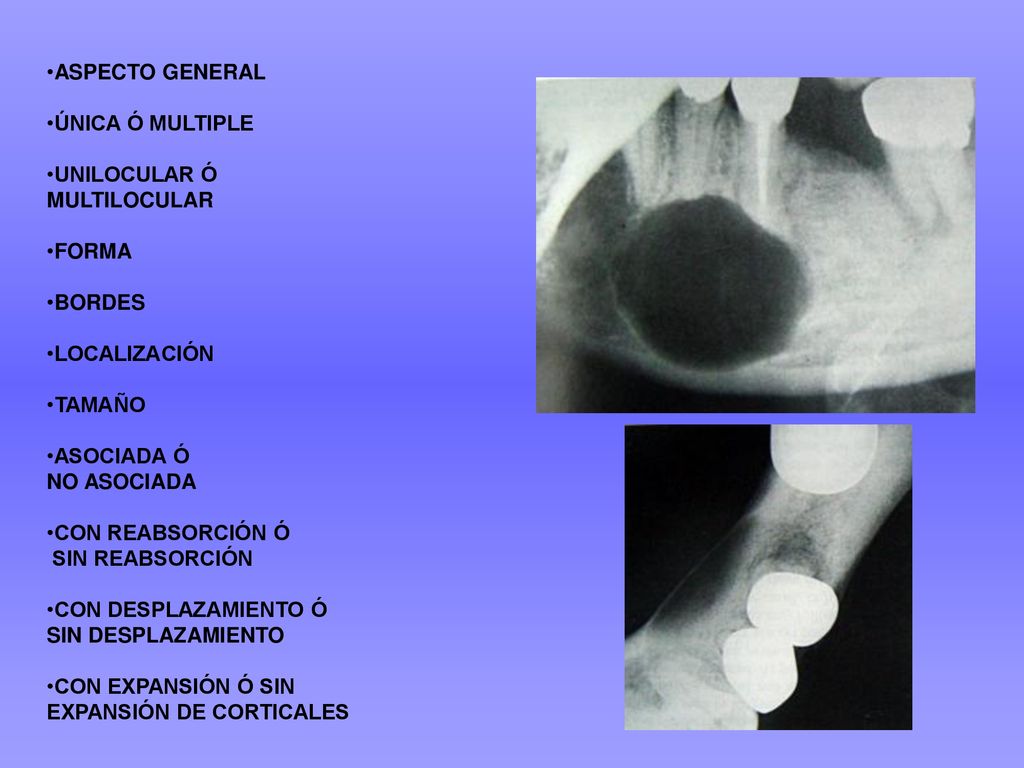 ASPECTO GENERAL ÚNICA Ó MULTIPLE. UNILOCULAR Ó MULTILOCULAR. FORMA. BORDES.