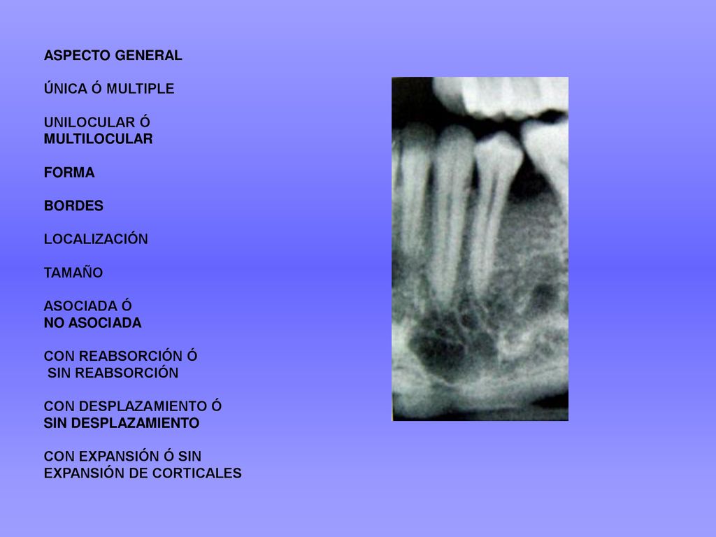 ASPECTO GENERAL ÚNICA Ó MULTIPLE. UNILOCULAR Ó MULTILOCULAR. FORMA. BORDES.