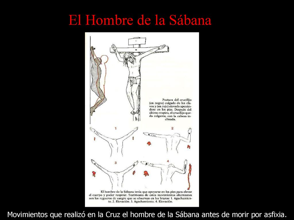 El Hombre de la Sábana Movimientos que realizó en la Cruz el hombre de la Sábana antes de morir por asfixia.