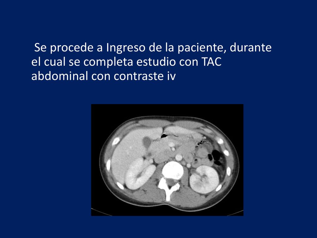Se procede a Ingreso de la paciente, durante el cual se completa estudio con TAC abdominal con contraste iv