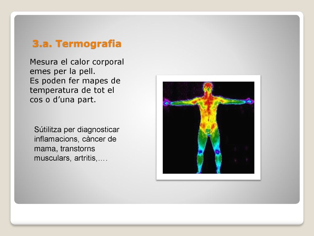 3.a. Termografia Mesura el calor corporal emes per la pell.