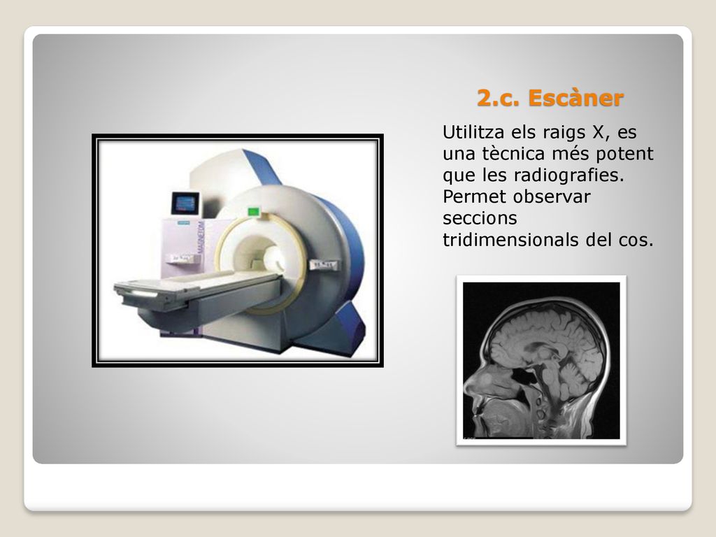 2.c. Escàner Utilitza els raigs X, es una tècnica més potent que les radiografies.