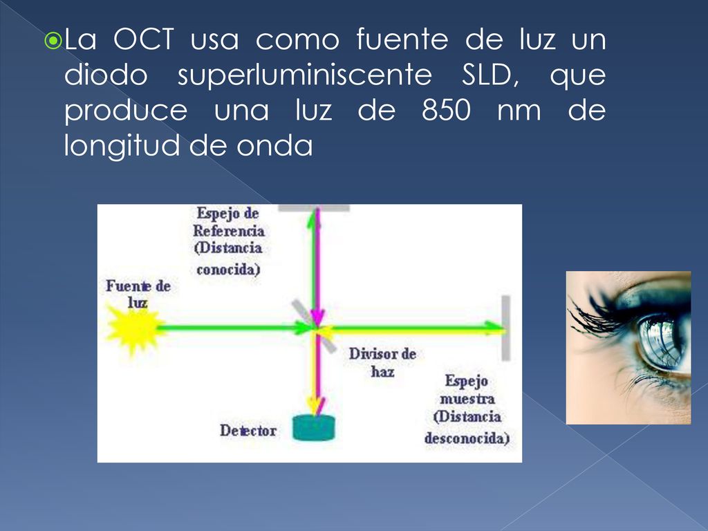 La OCT usa como fuente de luz un diodo superluminiscente SLD, que produce una luz de 850 nm de longitud de onda