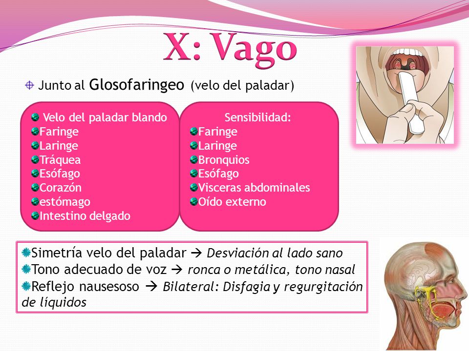 X: Vago Simetría velo del paladar  Desviación al lado sano