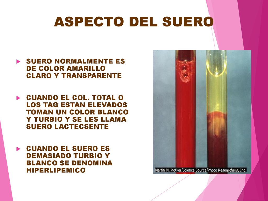 ASPECTO DEL SUERO SUERO NORMALMENTE ES DE COLOR AMARILLO CLARO Y TRANSPARENTE.