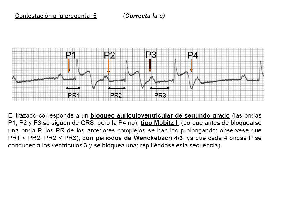 P1 P2 P3 P4 Contestación a la pregunta 5 (Correcta la c) PR1 PR2 PR3