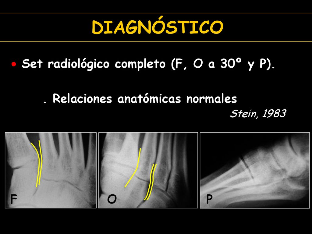 DIAGNÓSTICO Set radiológico completo (F, O a 30º y P).