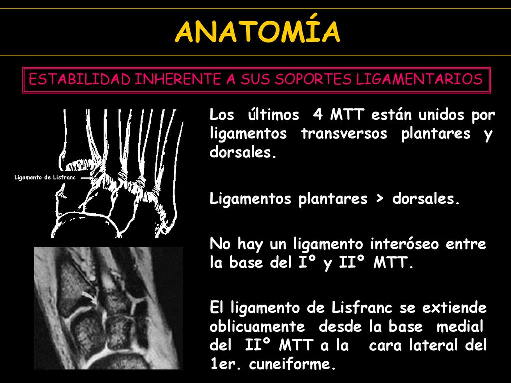 ANATOMÍA ESTABILIDAD INHERENTE A SUS SOPORTES LIGAMENTARIOS. Los últimos 4 MTT están unidos por ligamentos transversos plantares y dorsales.