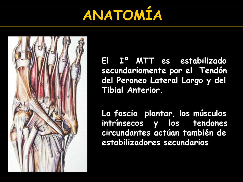 ANATOMÍA El Iº MTT es estabilizado secundariamente por el Tendón del Peroneo Lateral Largo y del Tibial Anterior.