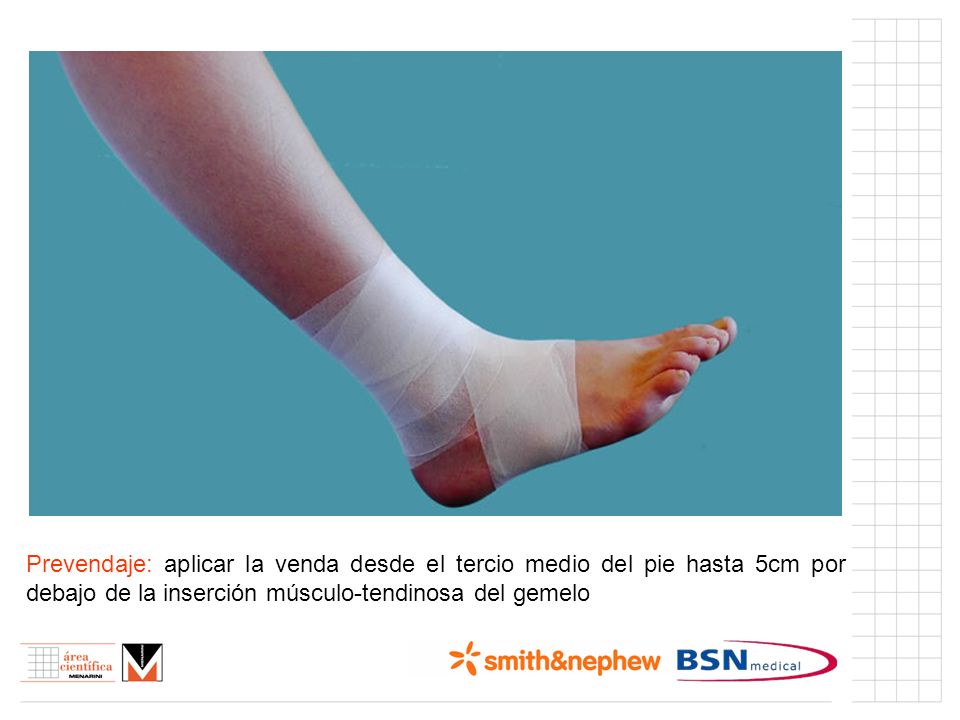 Índice (I) Prevendaje: aplicar la venda desde el tercio medio del pie hasta 5cm por debajo de la inserción músculo-tendinosa del gemelo.