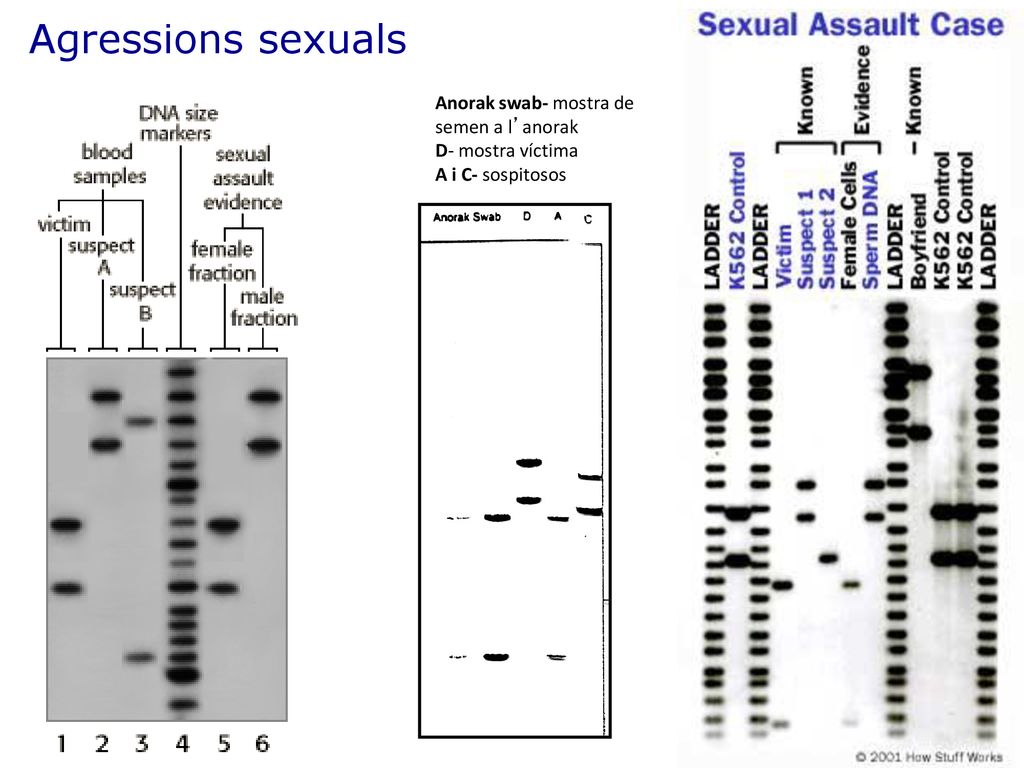 Agressions sexuals Anorak swab- mostra de semen a l’anorak