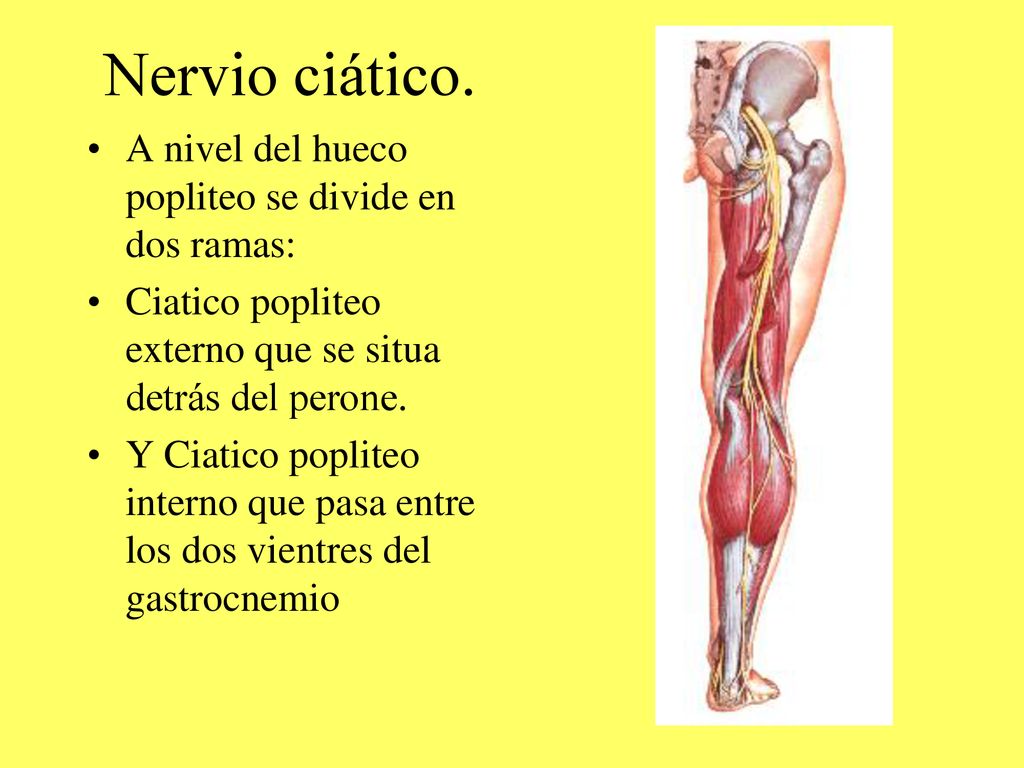 Nervio ciático. A nivel del hueco popliteo se divide en dos ramas: