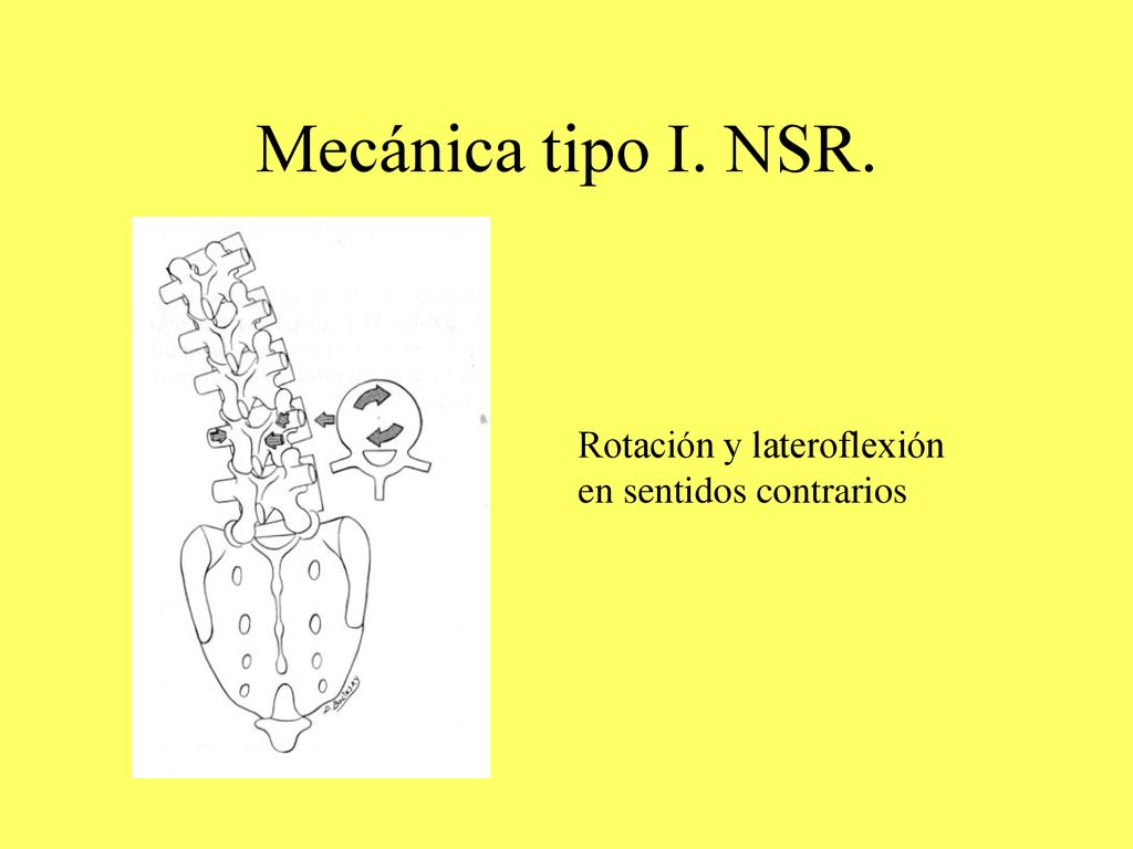 Mecánica tipo I. NSR. Rotación y lateroflexión en sentidos contrarios
