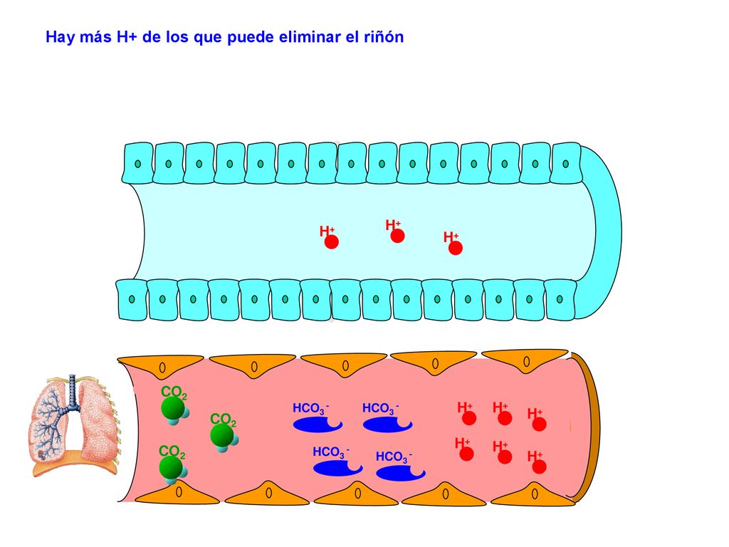 Hay más H+ de los que puede eliminar el riñón