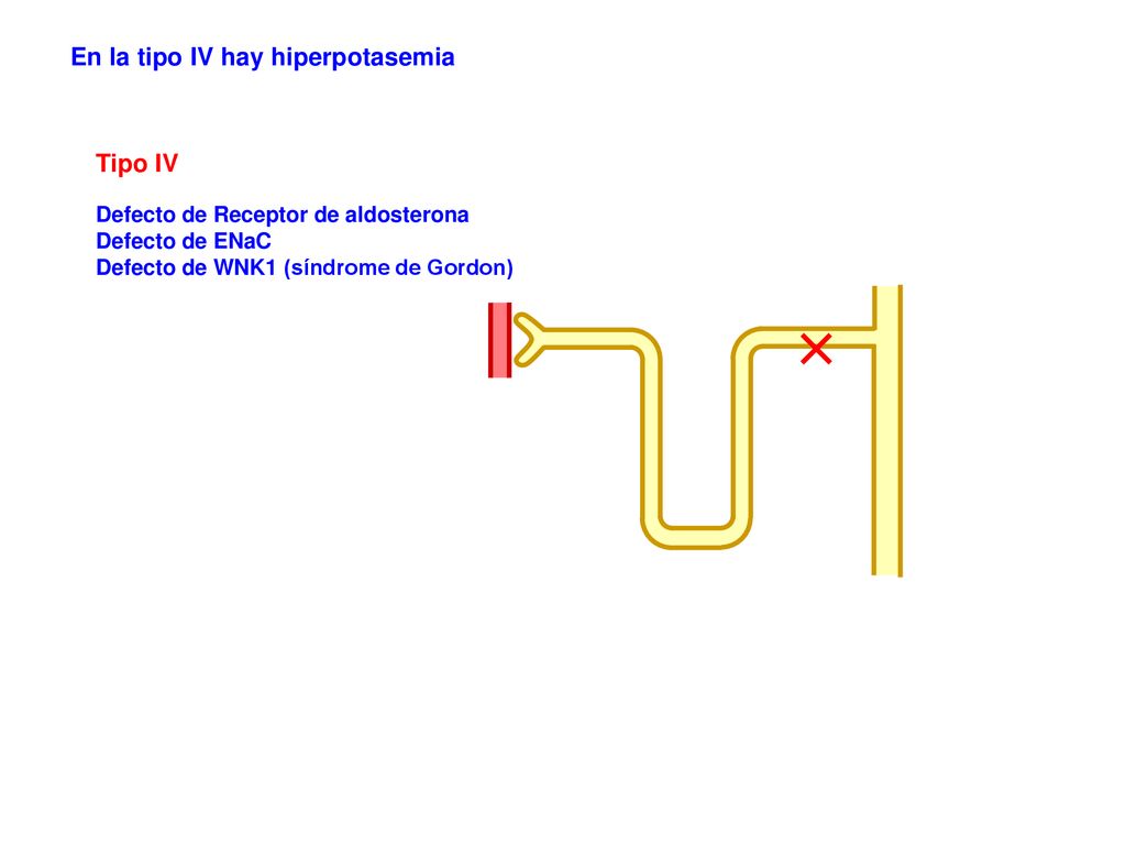 En la tipo IV hay hiperpotasemia
