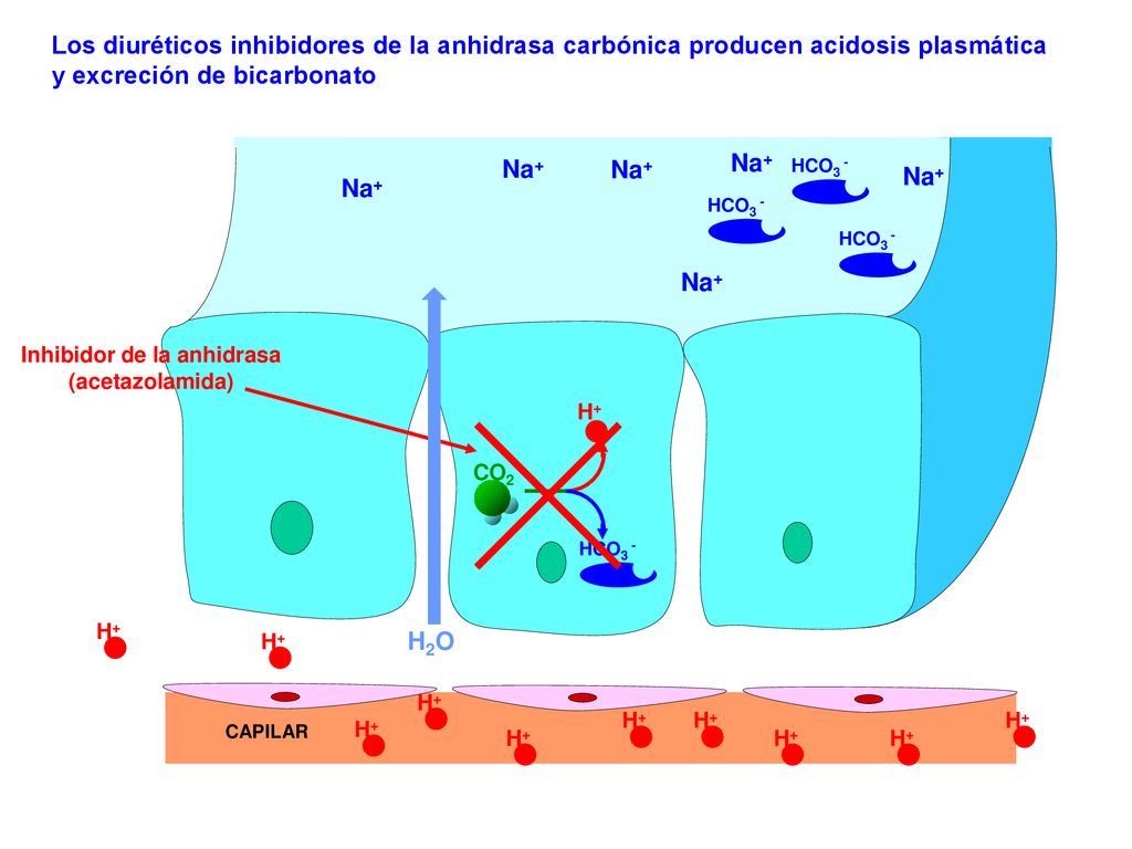 Inhibidor de la anhidrasa (acetazolamida)