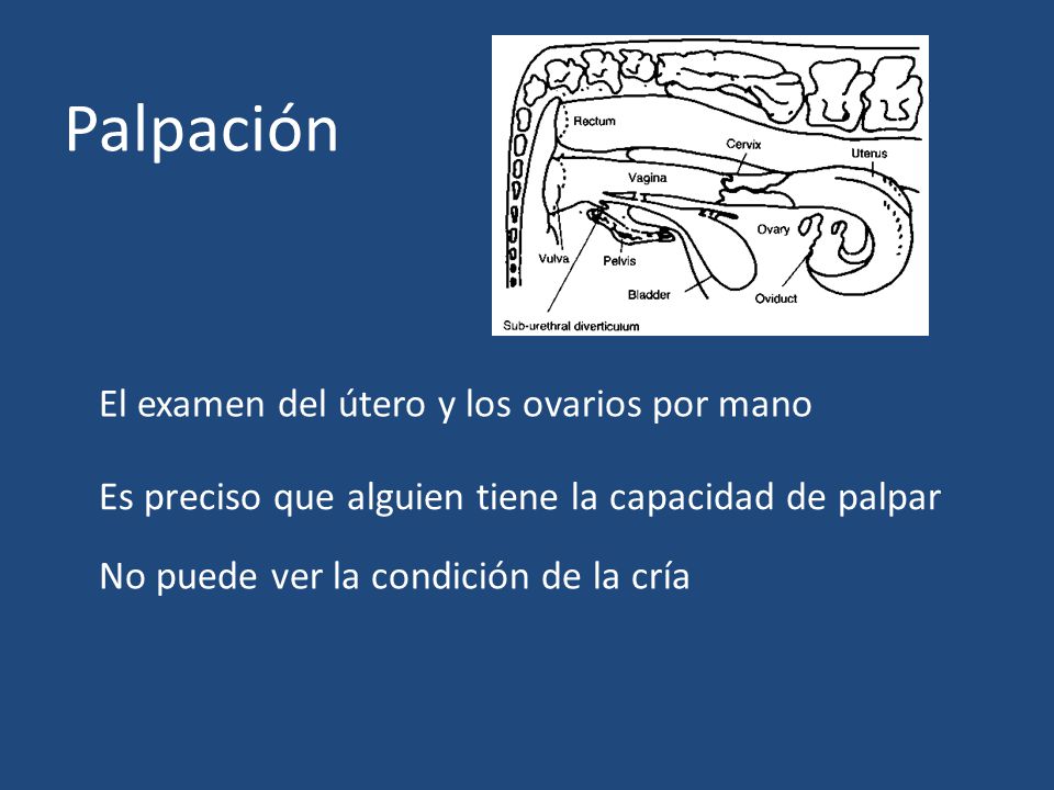 Palpación El examen del útero y los ovarios por mano