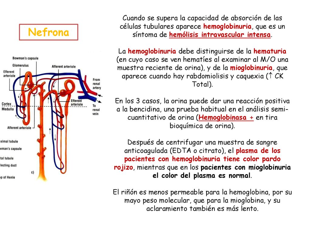 Cuando se supera la capacidad de absorción de las células tubulares aparece hemoglobinuria, que es un síntoma de hemólisis intravascular intensa. La hemoglobinuria debe distinguirse de la hematuria (en cuyo caso se ven hematíes al examinar al M/O una muestra reciente de orina), y de la mioglobinuria, que aparece cuando hay rabdomiolisis y caquexia ( CK Total). En los 3 casos, la orina puede dar una reacción positiva a la bencidina, una prueba habitual en el análisis semi-cuantitativo de orina (Hemoglobinasa + en tira bioquímica de orina). Después de centrifugar una muestra de sangre anticoagulada (EDTA o citrato), el plasma de los pacientes con hemoglobinuria tiene color pardo rojizo, mientras que en los pacientes con mioglobinuria el color del plasma es normal. El riñón es menos permeable para la hemoglobina, por su mayo peso molecular, que para la mioglobina, y su aclaramiento también es más lento.