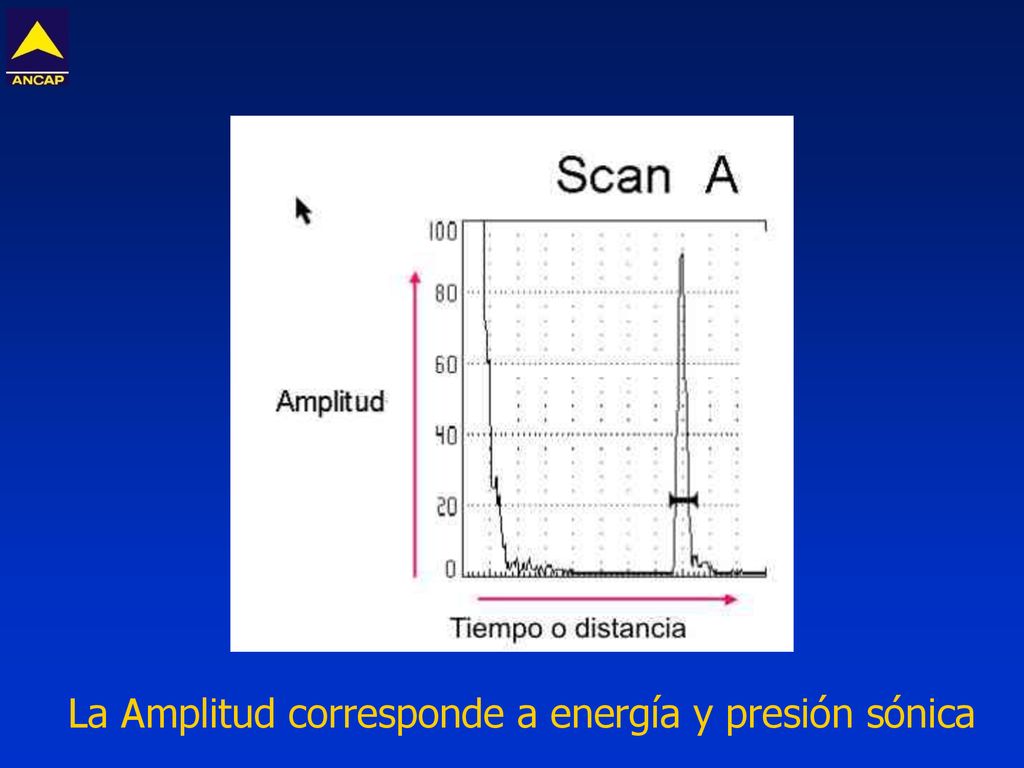 La Amplitud corresponde a energía y presión sónica