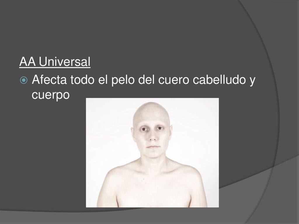 AA Universal Afecta todo el pelo del cuero cabelludo y cuerpo