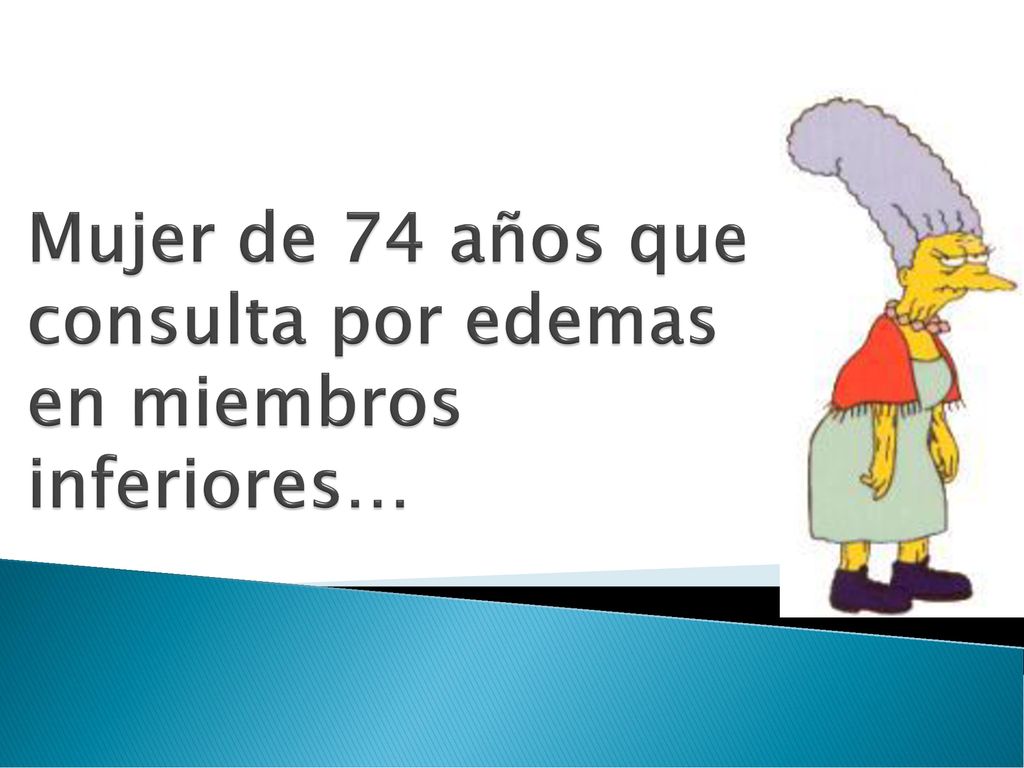 Mujer de 74 años que consulta por edemas en miembros inferiores…