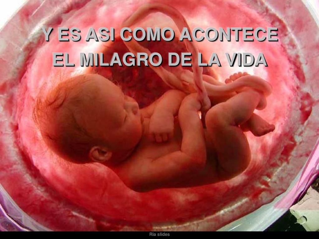 Y ES ASI COMO ACONTECE EL MILAGRO DE LA VIDA
