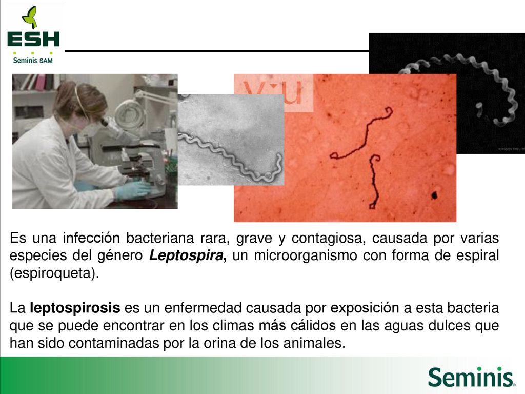 Es una infección bacteriana rara, grave y contagiosa, causada por varias especies del género Leptospira, un microorganismo con forma de espiral (espiroqueta).