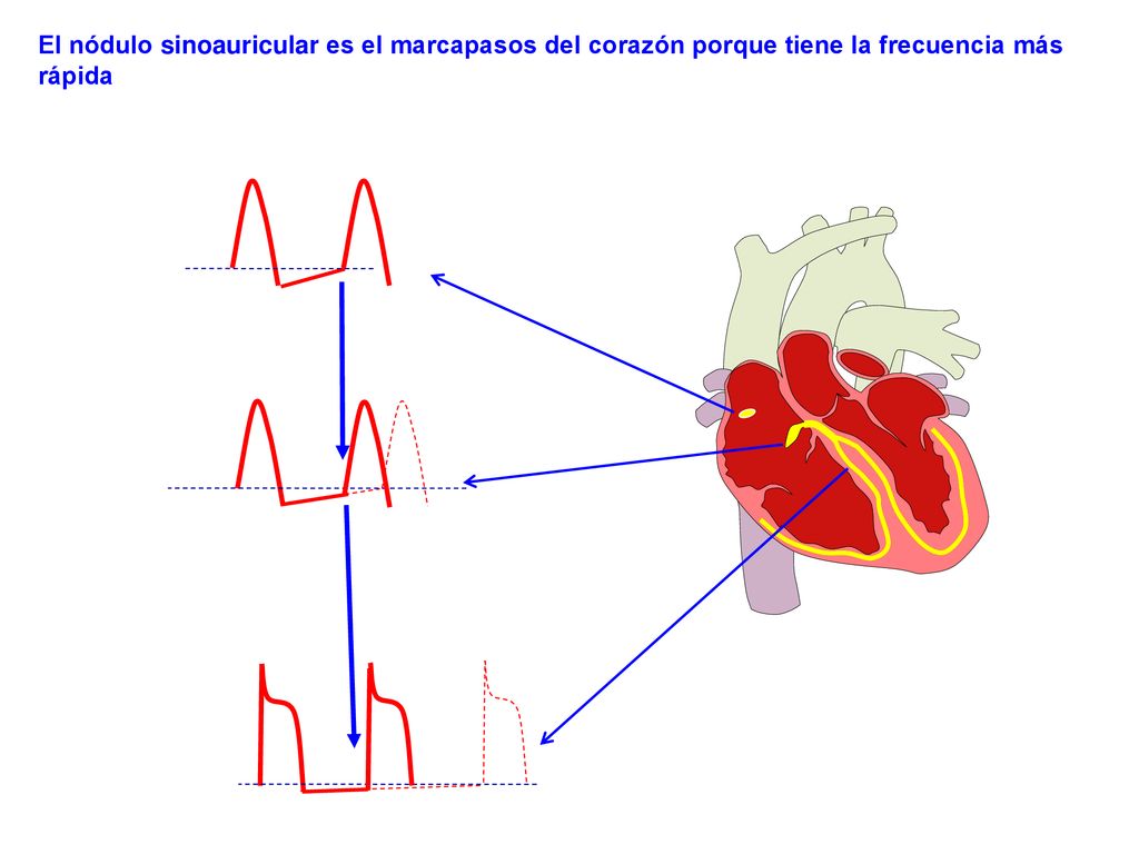 El nódulo sinoauricular es el marcapasos del corazón porque tiene la frecuencia más rápida