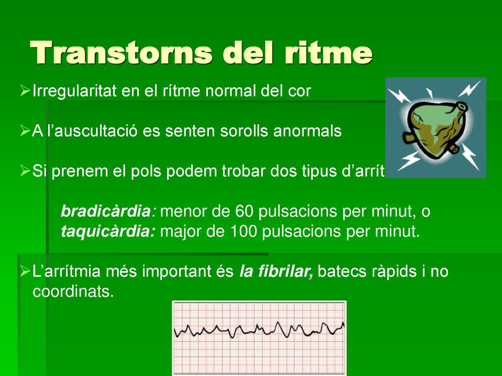 Transtorns del ritme Irregularitat en el rítme normal del cor