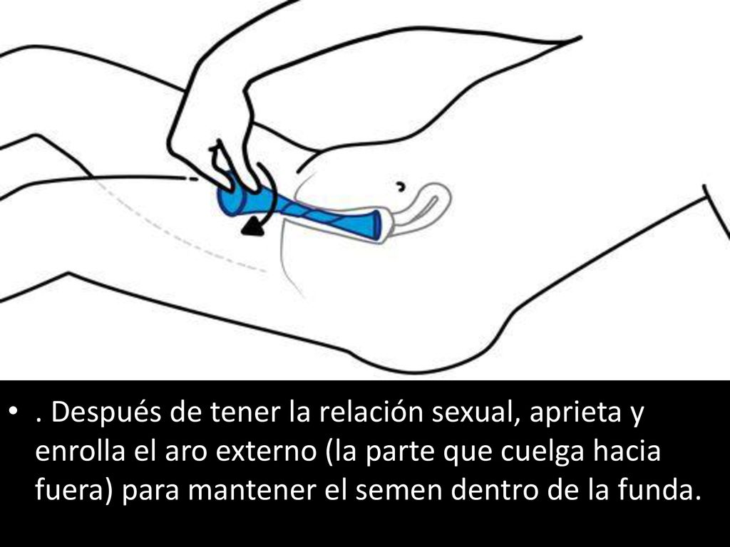 . Después de tener la relación sexual, aprieta y enrolla el aro externo (la parte que cuelga hacia fuera) para mantener el semen dentro de la funda.