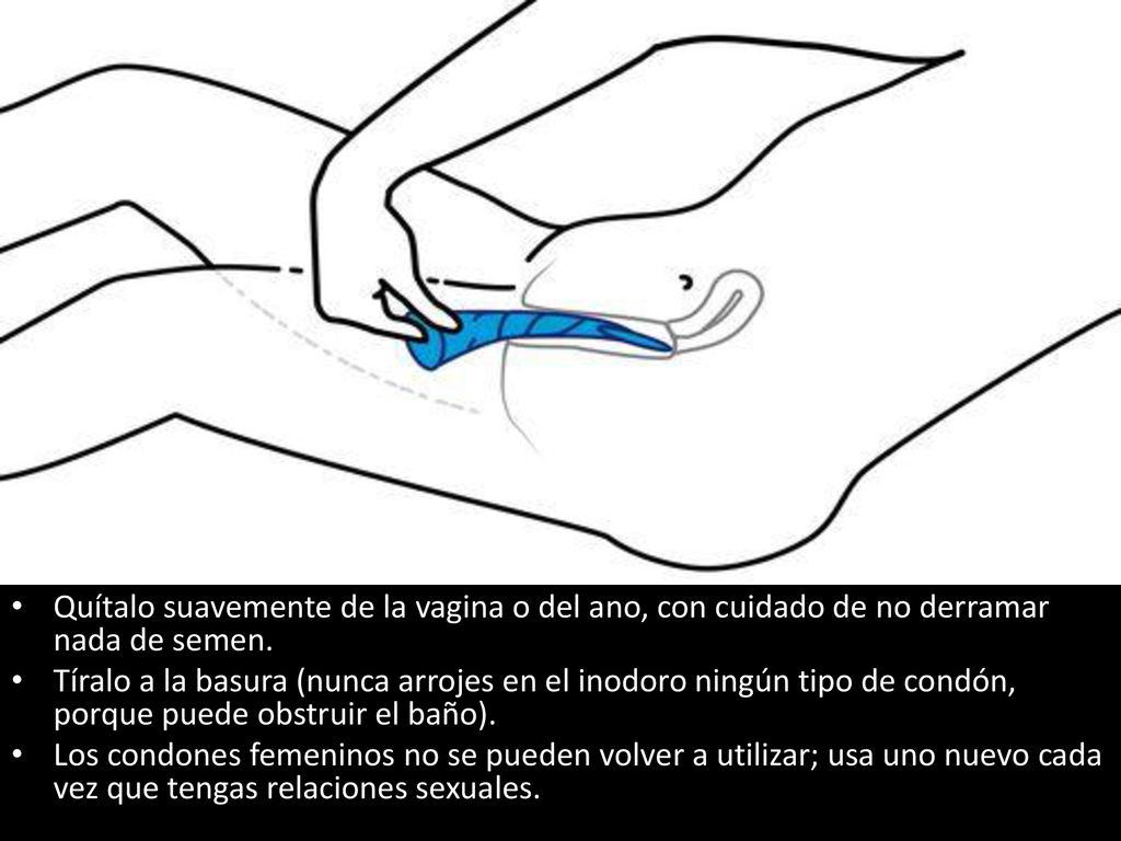 Quítalo suavemente de la vagina o del ano, con cuidado de no derramar nada de semen.