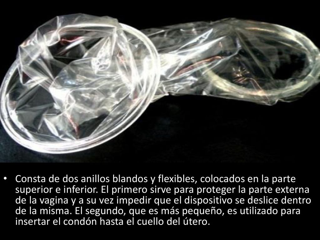Consta de dos anillos blandos y flexibles, colocados en la parte superior e inferior.