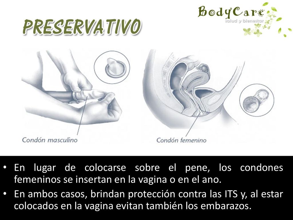 En lugar de colocarse sobre el pene, los condones femeninos se insertan en la vagina o en el ano.