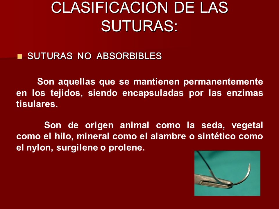 CLASIFICACION DE LAS SUTURAS: